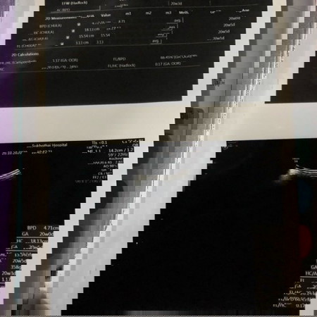 ซาวครั้งแรกมองไม่เห็นอะไรเลย
