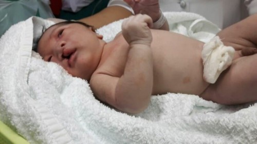 Pentingnya Support System