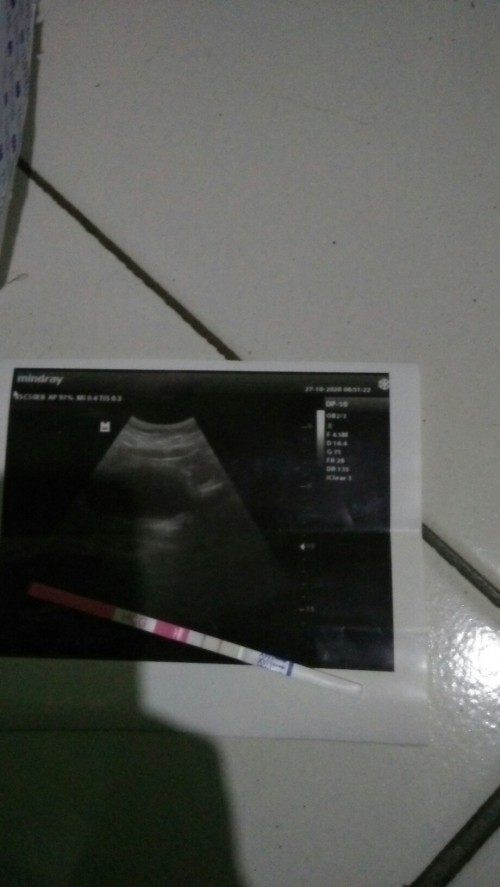 Saya ingin bertanya