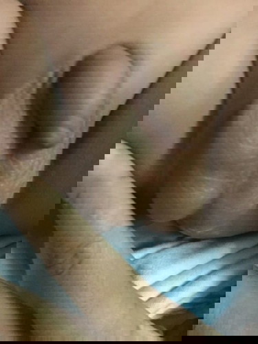 น้องอายุ 3 เดือนทันฑะน้องขึ้นมา3ลูกและมีรอยเขียวช้ำ เป็นอันตรายหรือเปล่าครับ