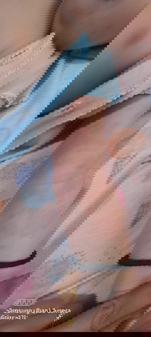 Merah² di badan bayi