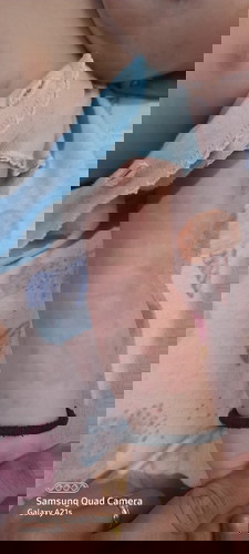 Merah² di badan bayi