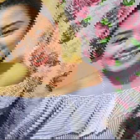 How to prevent stretch mark after birth ?