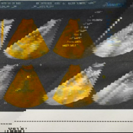 Minta Saran dan pendapat Moms