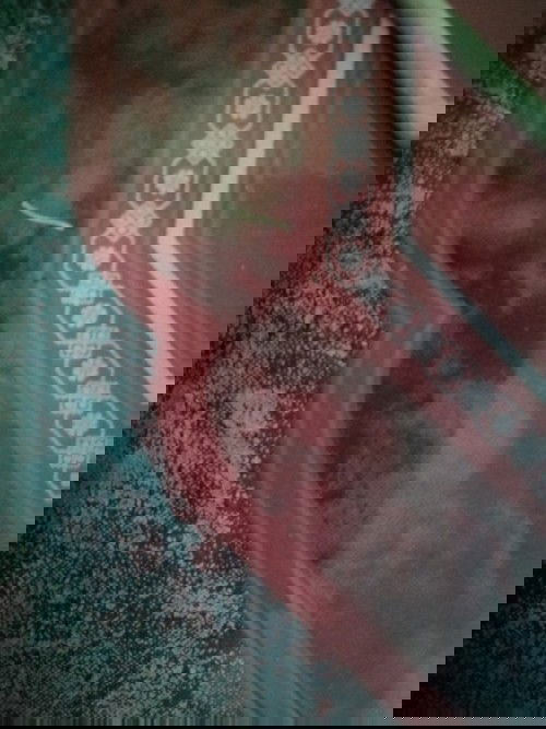 แผลฝีเย็บ​