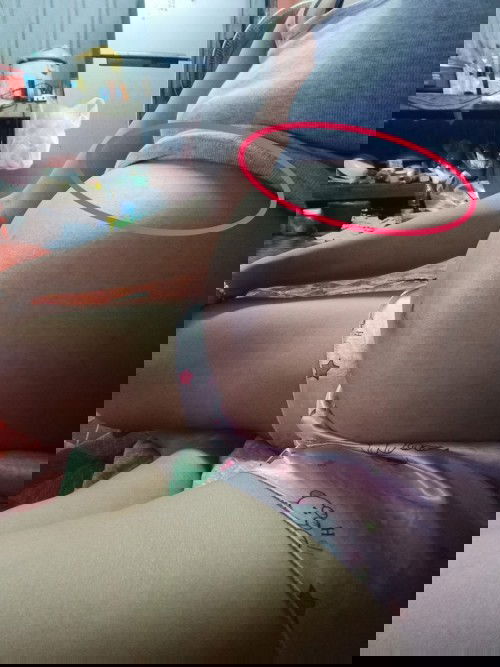 ทีม พ.ย แม่ๆมีอาการแบบนี้ไหมคะ