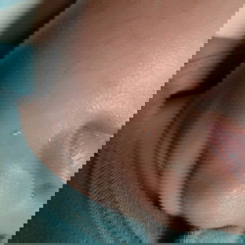 tanya bintik putih di wajah bayi