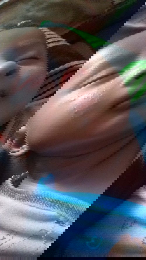 Bun Ada yg pernah seperti dde fatih pipinya?