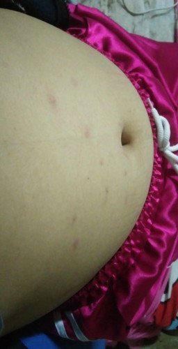 มีแม่ๆบ้านไหนเป็นไหมคะ