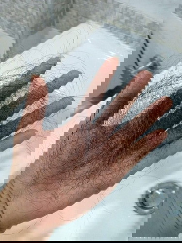 ผมร่วงหนักมาก
แม่ๆบ้านไหนเจอปัญหาเหมือนกันบ้างร่วงจนหน้าตกใจแล้วมีวิธีไหนบ้างที่ช่วยให้มันร่วงน้อยลง