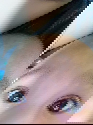 White patches on LO forehead and eyes.