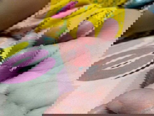 Kuliat jari mengelupas