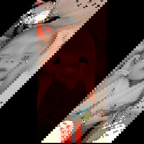 คลอดก่อนกำหนด 7 เดือน