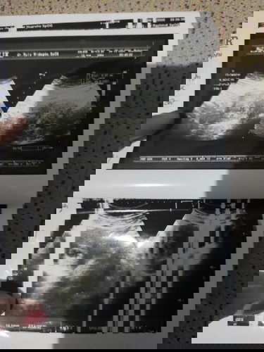 Butuh masukan pendapat biar mempersiapkan diri untuk kabar terburuk