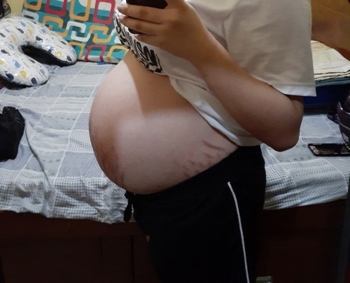 37 weeks ftm