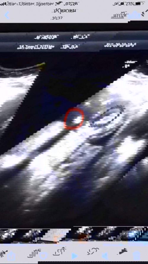 เพศหญิงรึชายคะ💕💕💕หมอบอกผู้ชายแต่ไม่100%