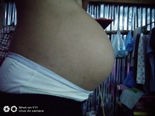 มีใครท้องเล็กแบบนี้บ้างค่ะ