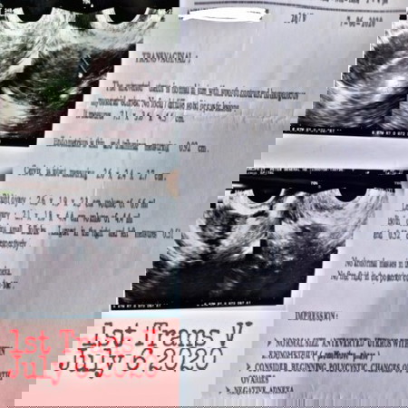 TransV and Pelvic Utz