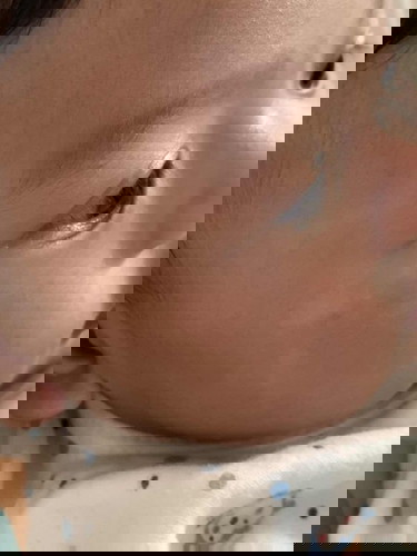 Is this ring worm? 😭😭