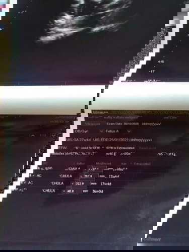 ดูอย่างไง บอกหน่วยค่ะ