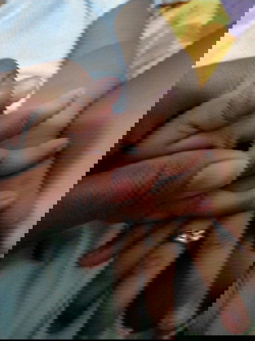 Bunda tau gak in kena apa