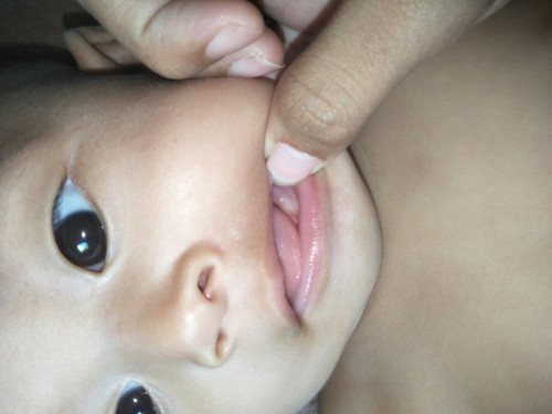 ฟันน้องขึ้นกันตอนกี่เดือนคะ