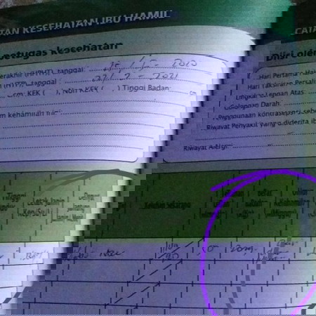 Denyut jantung