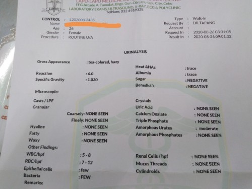 Urinalysis results