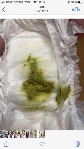 อึสีเขียวแบบนี้คือปกติไหมค่ะ