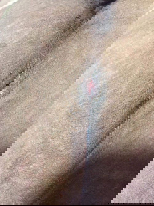 Nag open yung tahi 3weeks napo CS ko