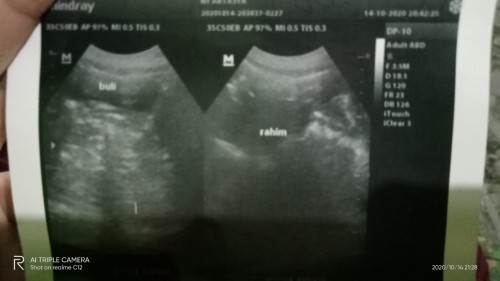 Usg masih belum kelihatan