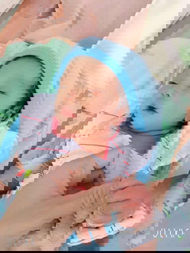 คลอดก่อนกำหนด