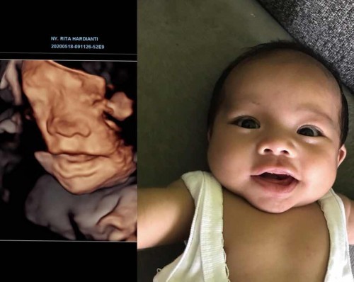 Mirip berapa persen bun? 😅