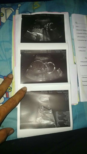 19+1 ลูกสาว 99% 😍