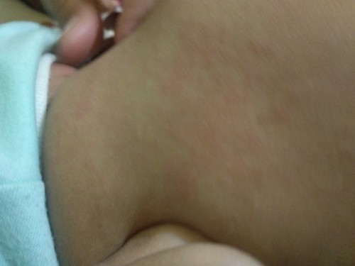 merah2 pada bayi kenapa yaa ?
bunda ada yg tau knp ya bayi aku belakang kepalanya merah2