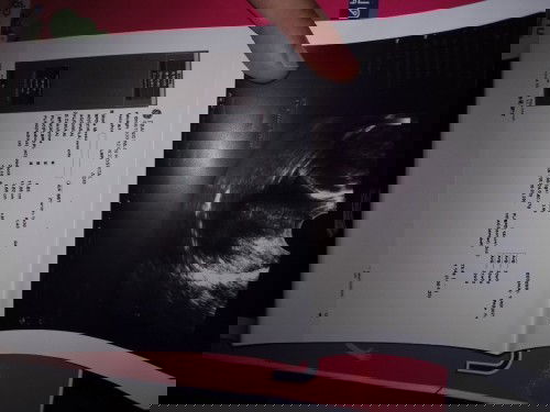 อยากรู้จ้าแม่ๆตอบหน่อยนะคะ