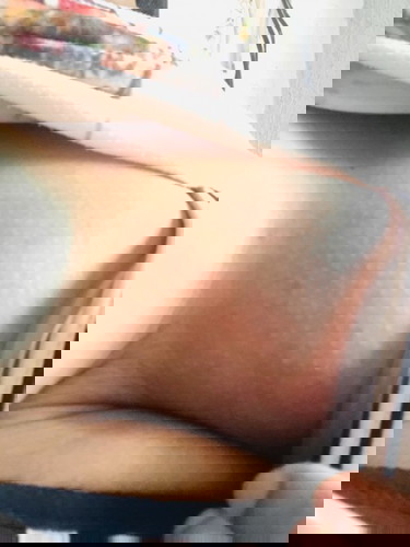 Redness, swelling and Pain breast.