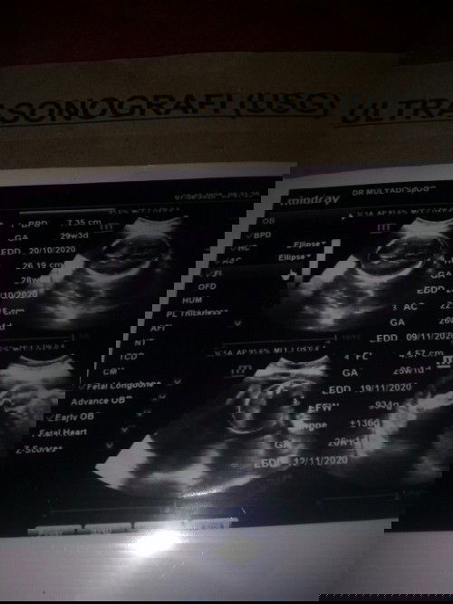 Bantu jawab dong bun 🙏 HPL Hasil USG