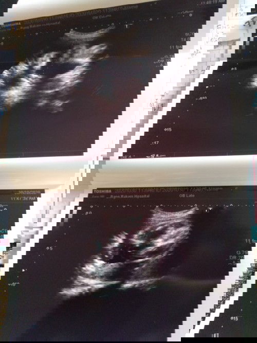 ดูไห้หน่วยค่ะ