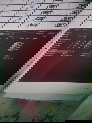 อัลตร้าซาวด์แล้วทำไมไม่มีรูปเด็ก