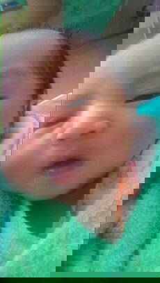 ความเจ็บปวดที่งดงาม