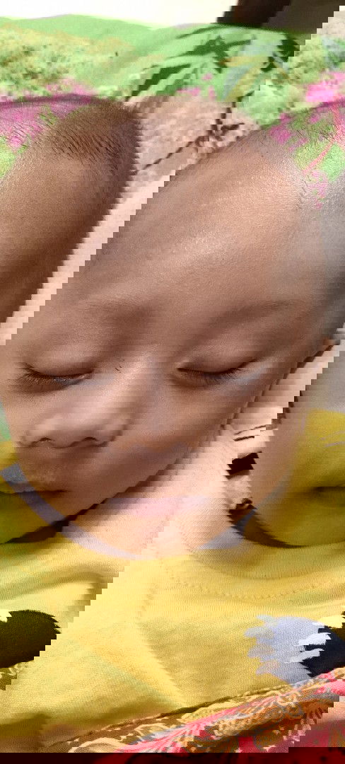 Cream untuk muka bayi yg belang