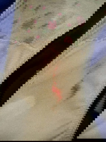 1to2cm palang po ako and may ganyan na pong lumalabas sakin ano po ibig sabihin nyan?