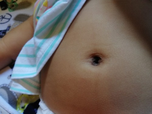 ลูกสาวสะดือดำแบบนี้ เช็ดยังไงได้บ้างคะ