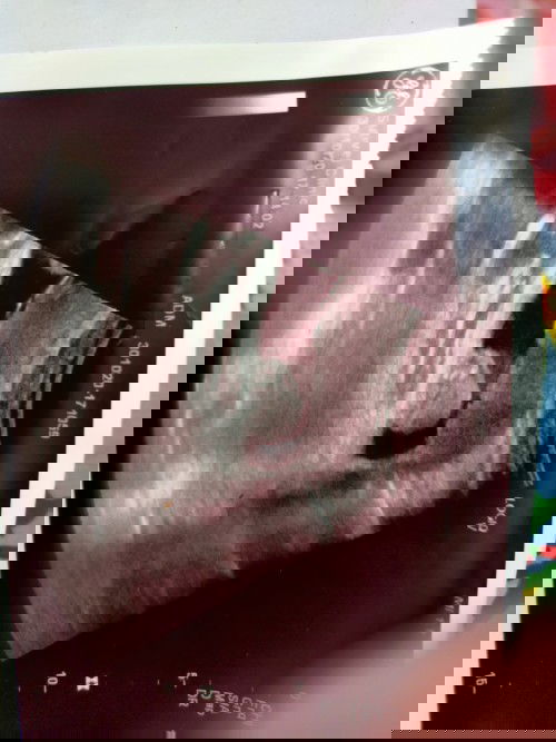 อิแม่ไม่แน่ใจ