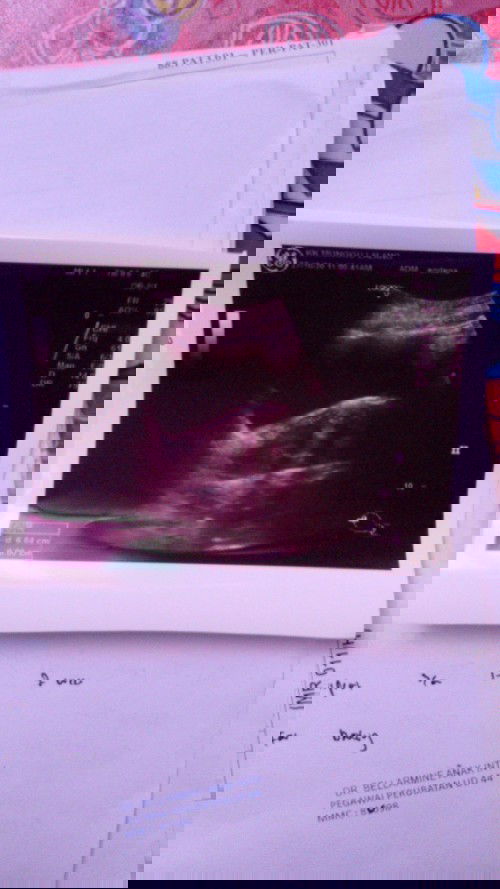 Gugur pada 16/09/2020.. pada hari itu start pendarahan..