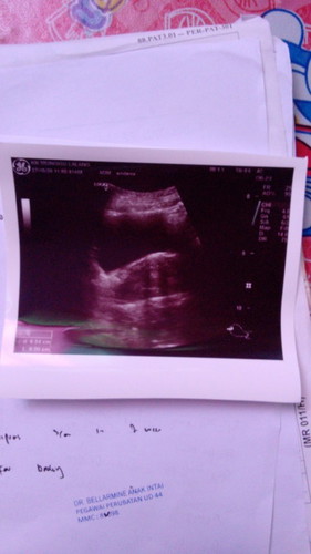 Gugur pada 16/09/2020.. pada hari itu start pendarahan..