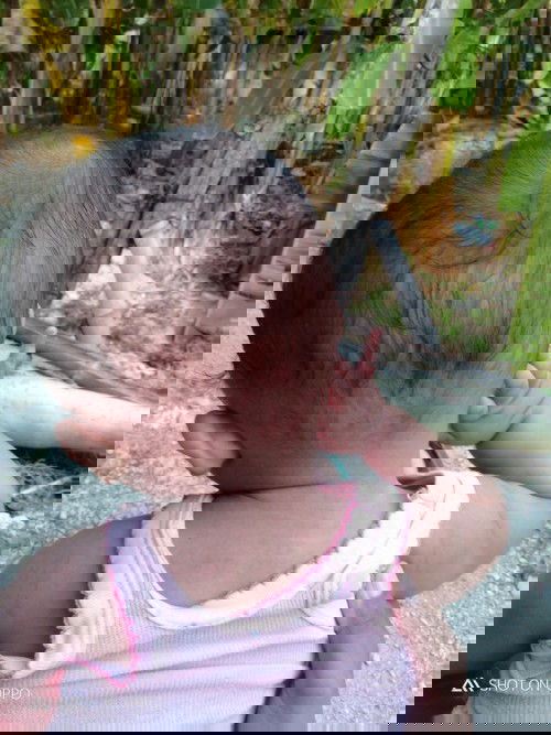 Kepala miring sebelah