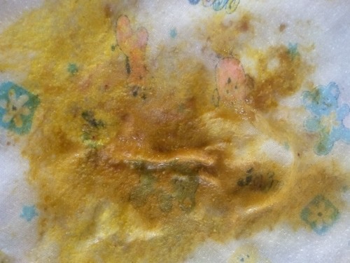 น้อง5เดือนกินนมแม่ถ่ายเหลวมีมูกเลือดปนเป็นไรค่ะ น้องไม่ร้อง ไม่เป็นไข้ ร่าเริงดีค่ะ