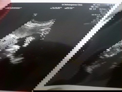 ช่วยดูหน่อยค่ะ